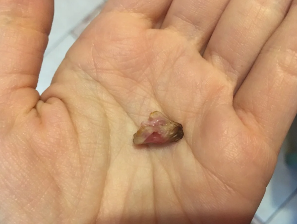 Як відрізнити натуральне м'ясо від накачаного хімією за 30 секунд: простий спосіб