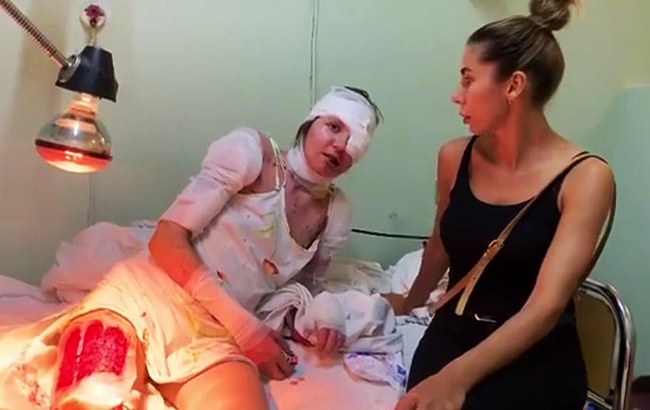 Вылил кипяток в рот: новые подробности жестокого инцидента с девушкой в Запорожье (видео)