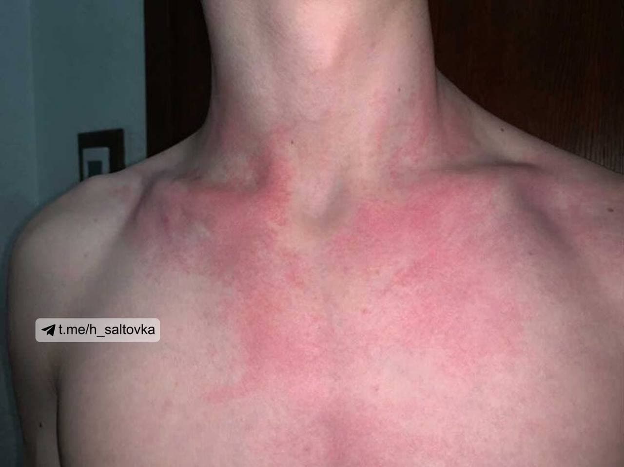 "Укрзализныця" вляпалась в новый скандал: пассажиры пожаловались на укусы