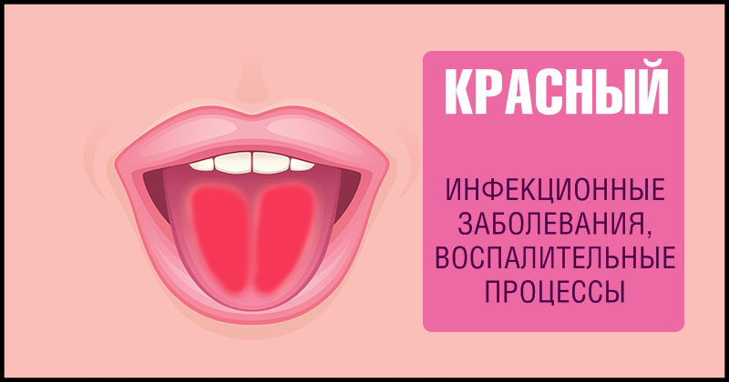 9 фактов о здоровье, о которых может рассказать наш язык
