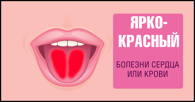 9 фактов о здоровье, о которых может рассказать наш язык