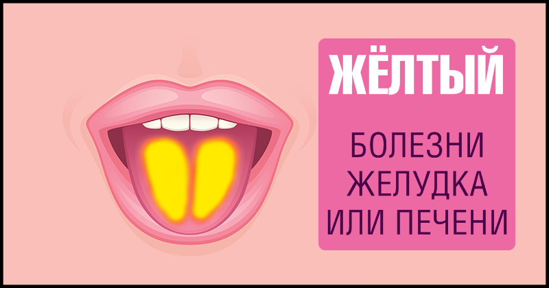 9 фактов о здоровье, о которых может рассказать наш язык