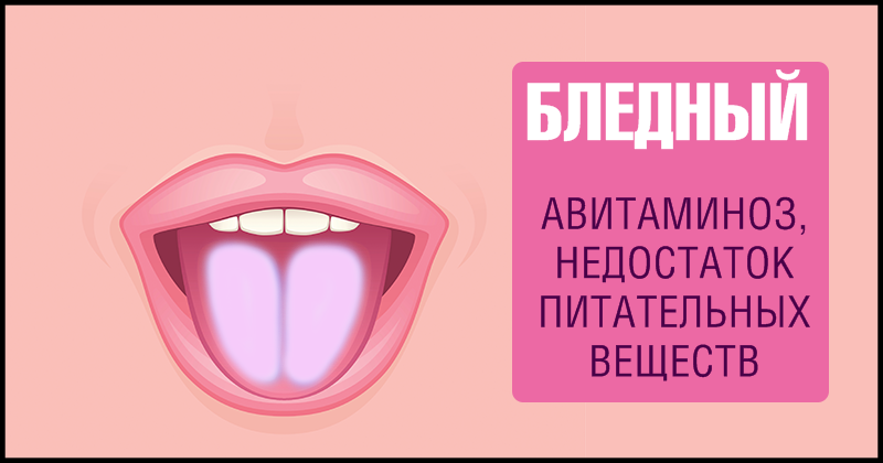 9 фактов о здоровье, о которых может рассказать наш язык