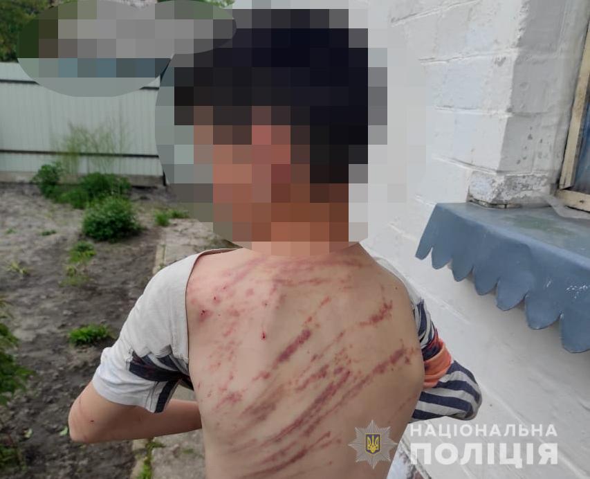На Волині мати і вітчим знущалися над дитиною: в хід йшли колючі гілки і кропива