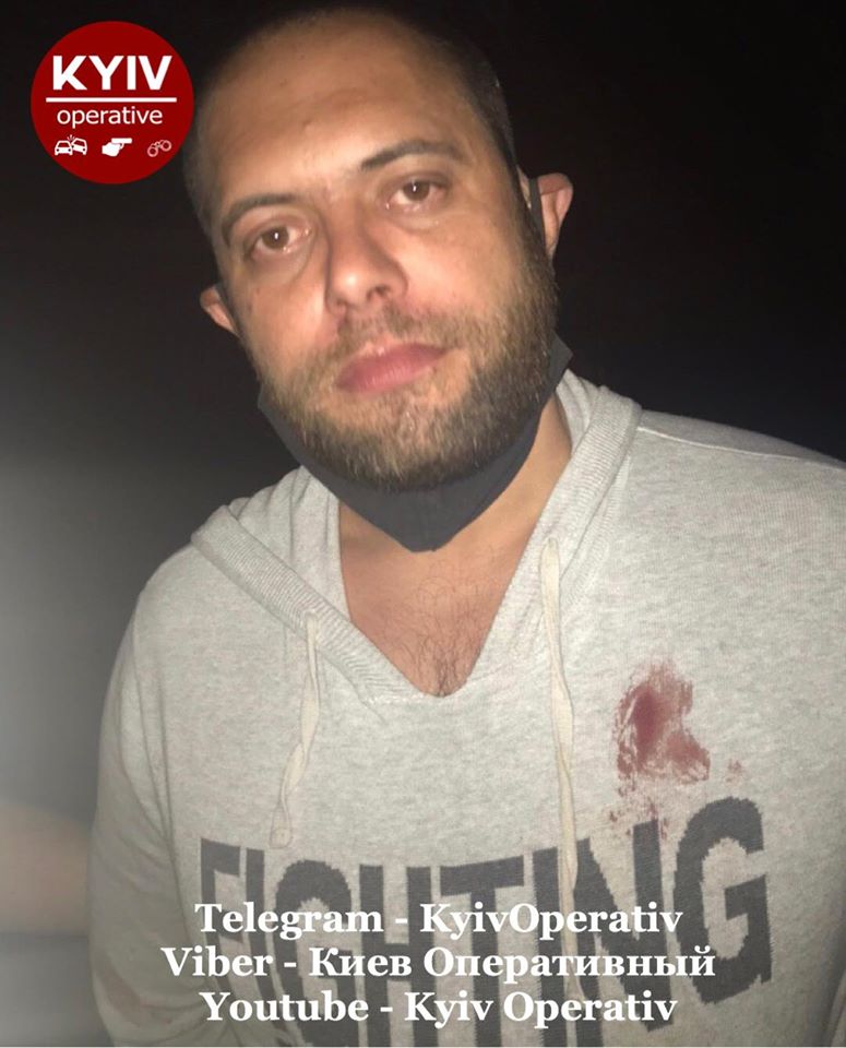 В Киеве воров настигла мгновенная расплата: фото "героев"