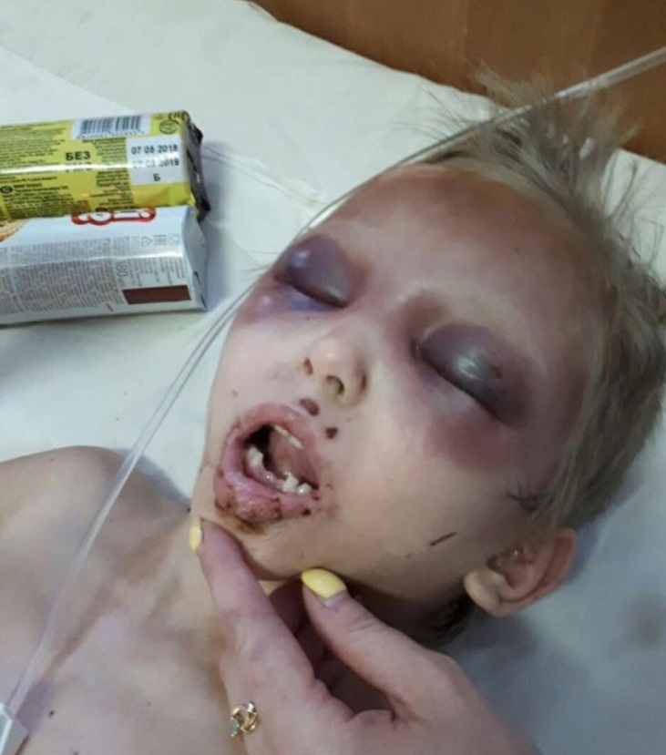 Колола голкою і била: в історії зі знущанням над дитиною в Дніпрі новий поворот