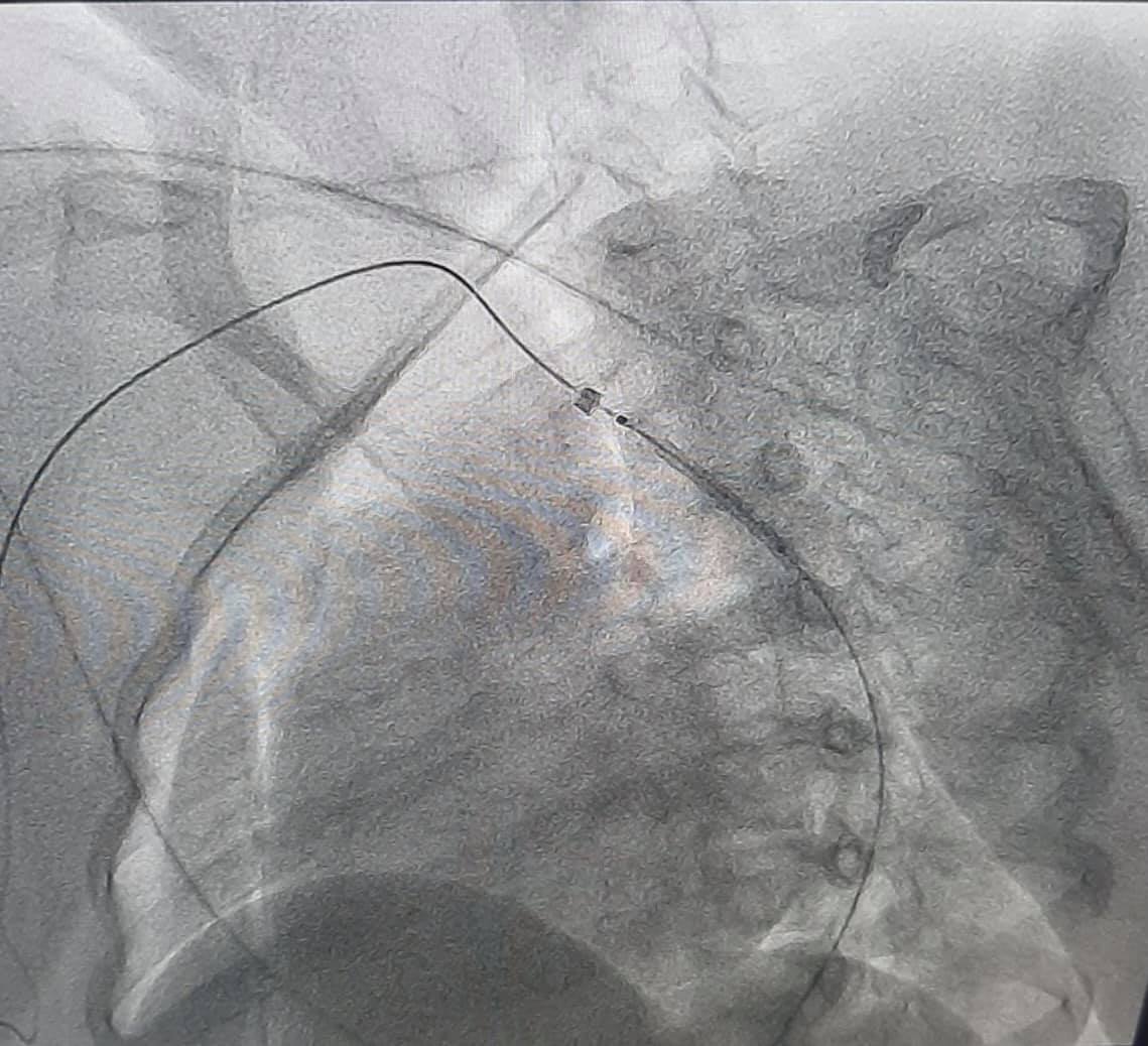 В Украине впервые провели операцию с помощью виртуальной реальности