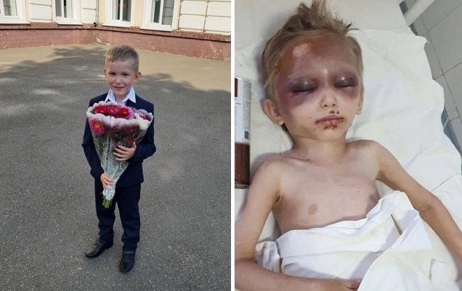 Колола голкою і била ногами: нові деталі про матір-садистку з Дніпра (відео)