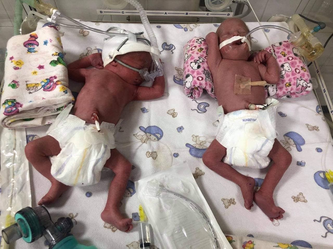 На Закарпатті 20-річна жінка народила одразу чотирьох малюків