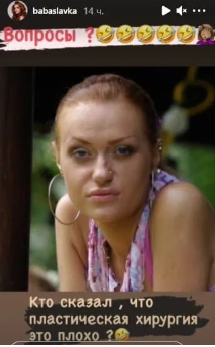 Кто сказал, что это плохо? Слава Каминская показала, как выглядела до пластики