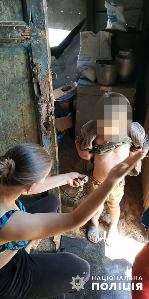 На Донбассе горе-отец держал 6-летнего сына на цепи: шокирующие фото
