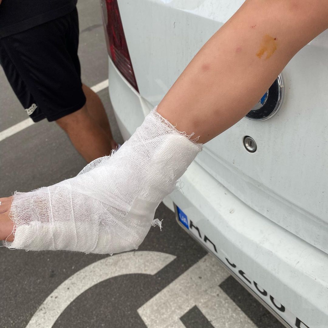 У київському ТРЦ на дитину впала вітрина: у хлопчика порізи на тілі і перелом ноги