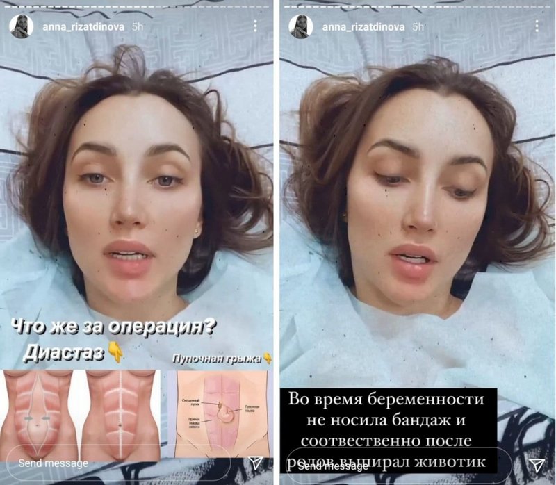 Анна Ризатдинова оказалась в больнице и рассказала об операциях: была огромная проблема