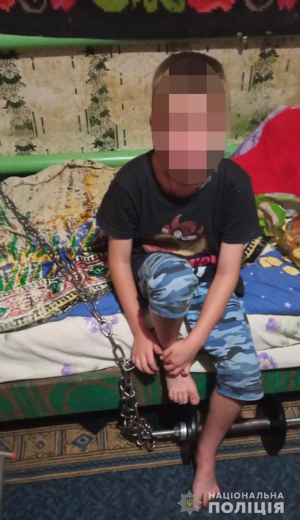 У Кривому Розі 7-річного хлопчика тримали на ланцюгу і били: дитина сама викликала поліцію