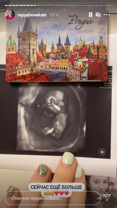 Вагітна дружина Віктора Павліка поділилася першим фото дитини