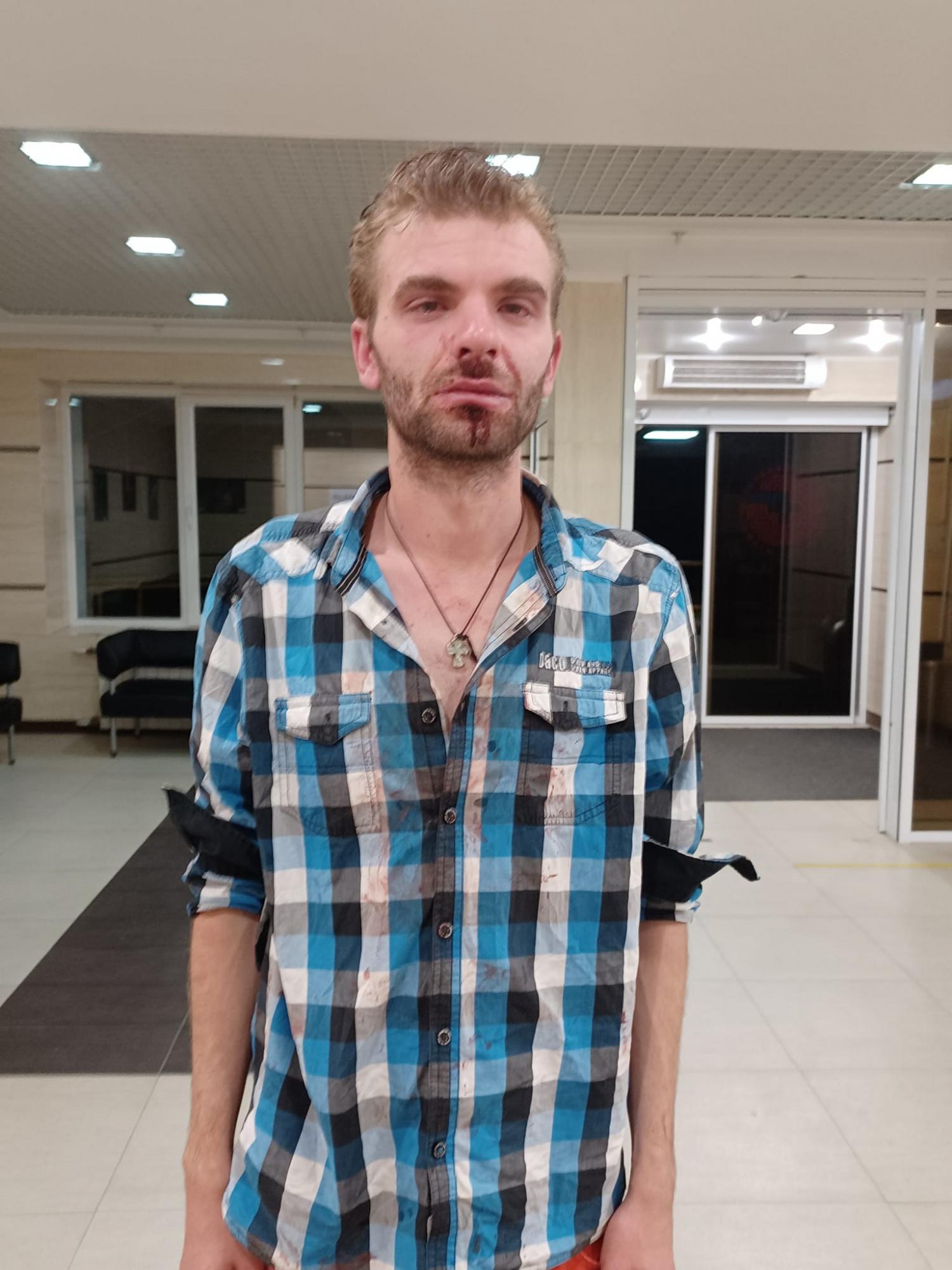 В центре Львова избили уличных музыкантов: подумали, что они из ЛГБТ-сообщества