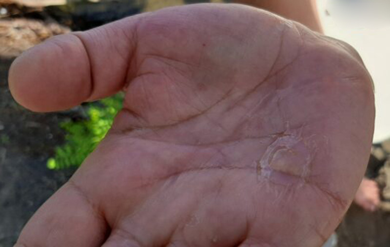 У Києві б'ють на сполох через аномальне нашестя медуз: у чому причина