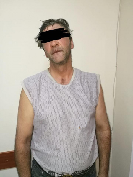 В Одесі дитину облили кислотою