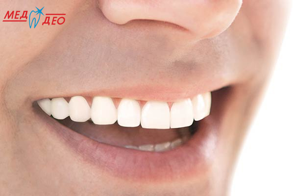 Лечение зубов по современным методам