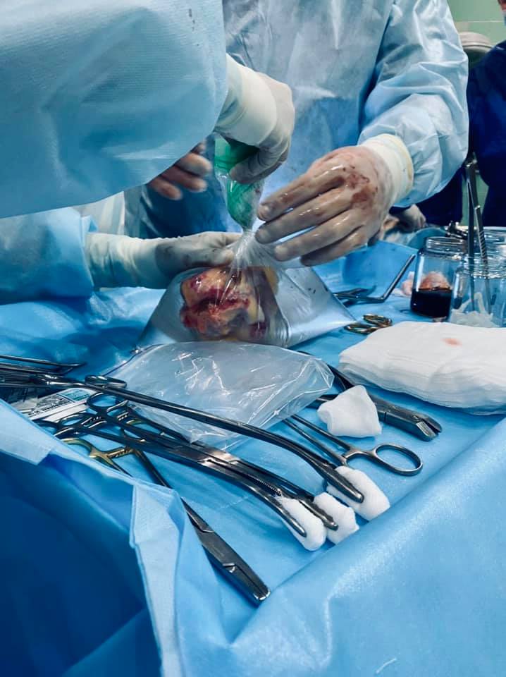 Українець після смерті врятував чотирьох людей, включаючи дитину: фото унікальної операції