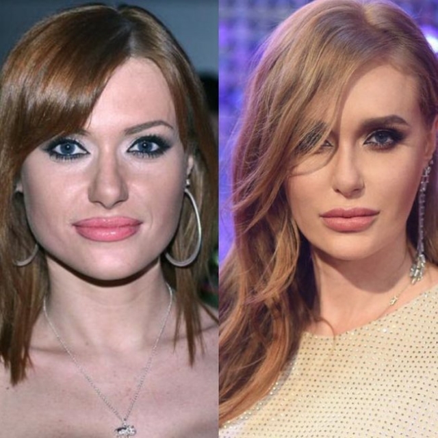 Кто сказал, что это плохо? Слава Каминская показала, как выглядела до пластики