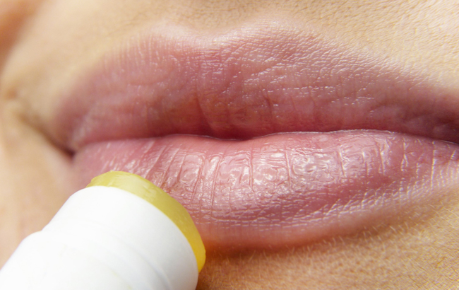 Топ-4 поради, які допоможуть позбутися від сухості губ