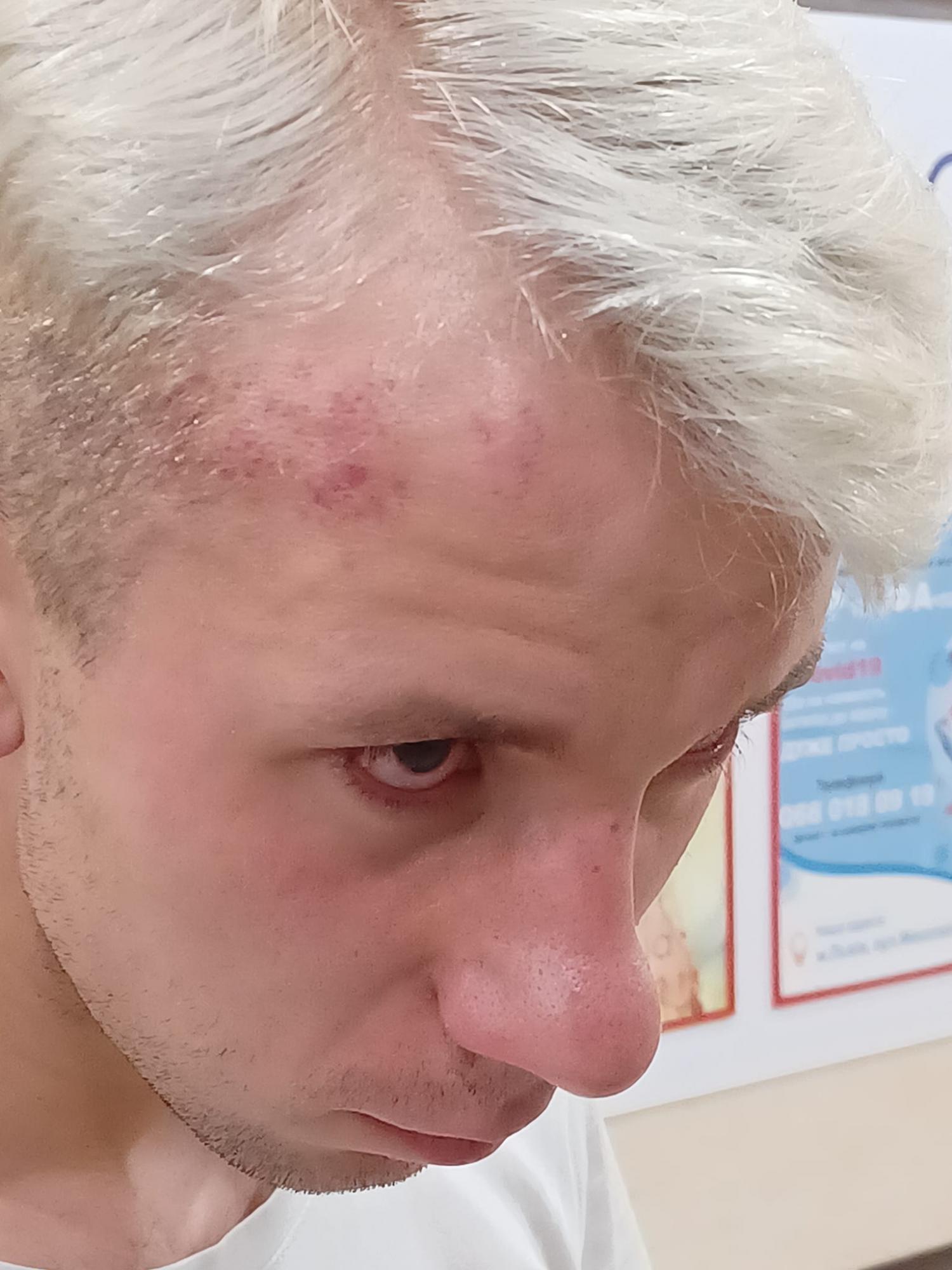 В центре Львова избили уличных музыкантов: подумали, что они из ЛГБТ-сообщества