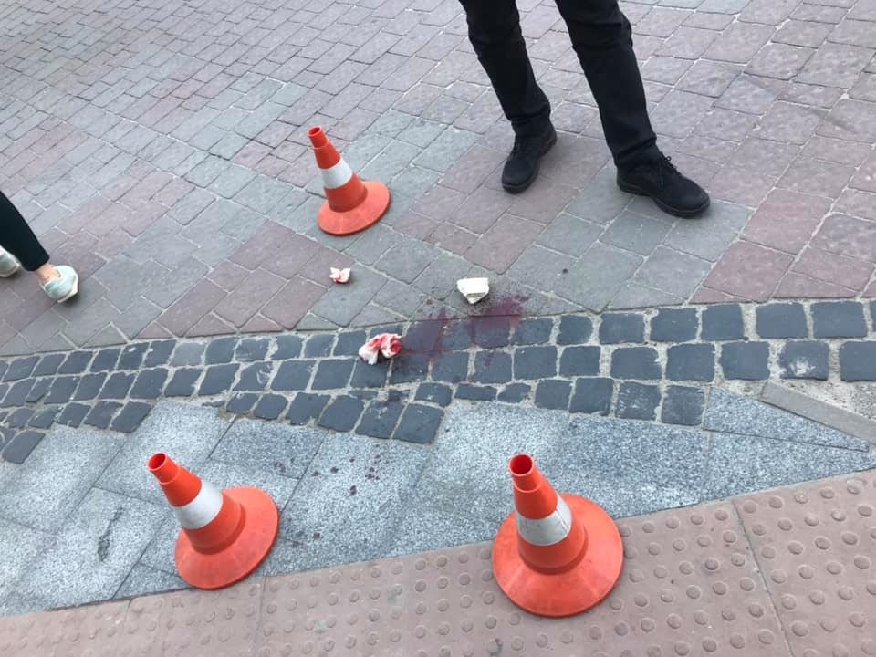 В центре Львова девушке на голову упал камень: подробности (фото)