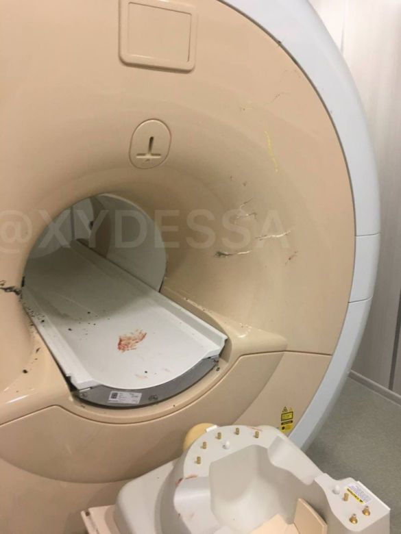В Одесі у приватній клініці жінку засмоктав апарат МРТ разом з інвалідним візком