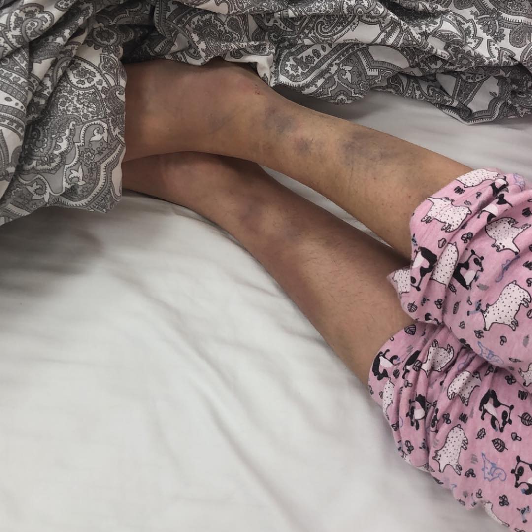 Состояние певицы МакЅим ухудшилось: что известно