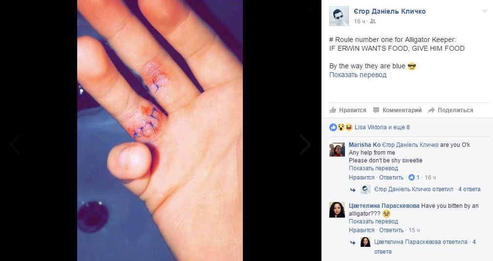 Сина Віталія Кличка покусав крокодил