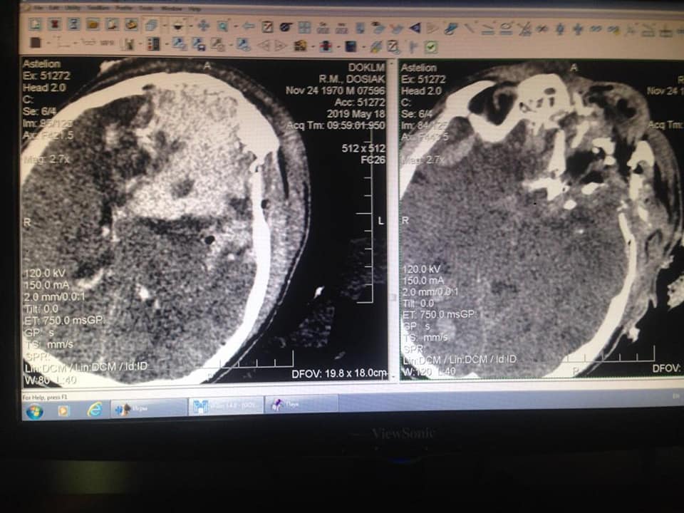 Боролися за життя 5 діб: у лікарні в Дніпрі помер тяжко поранений воїн (фото)
