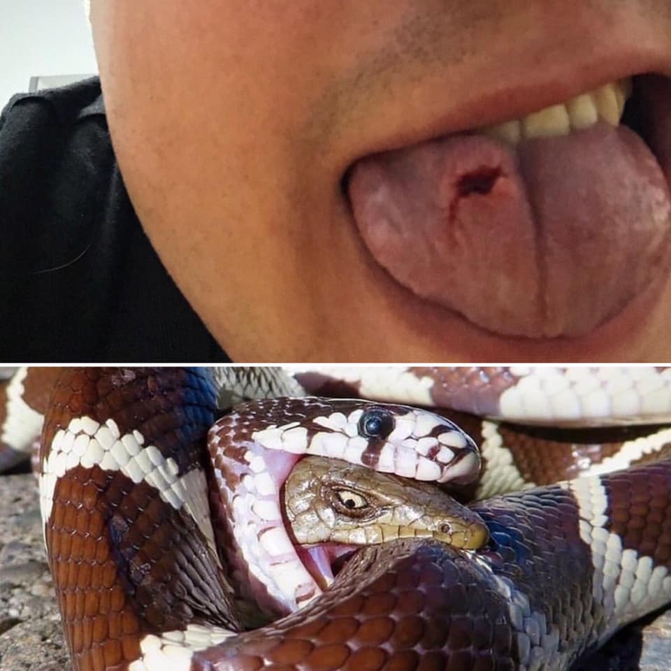 Искусал лицо и плечи: в Киеве журналист жестоко избил экс-возлюбленную (фото)