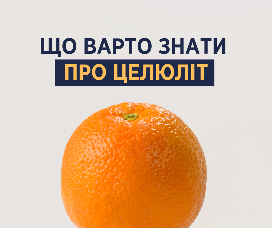 Це не хвороба: Супрун розвіяла міфи про целюліт
