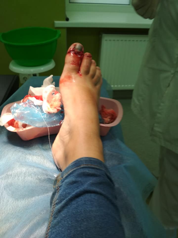 У київському аеропорту на дитину впала шафа: подробиці інциденту (фото, відео)