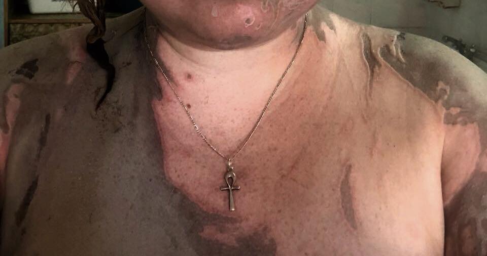 Ты увидела глаза палача: отец Гандзюк показал жуткие фото нападения на дочь