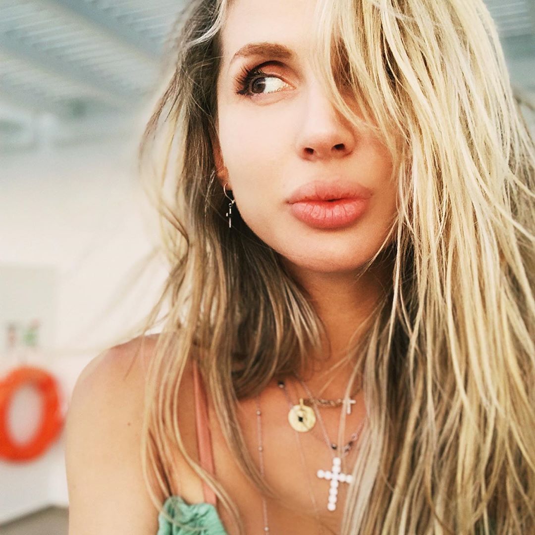 Переборщила: Лободу уличили в новой пластической операции