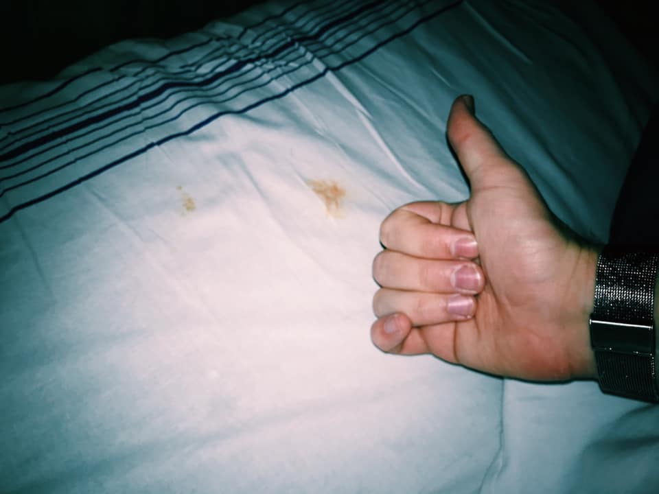 Це кров або соус? Укрзалізниця влипла в подвійний скандал