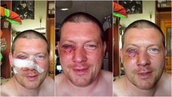 Автохамы по-звірячому побили рятувальника: деталі інциденту в Києві (фото)