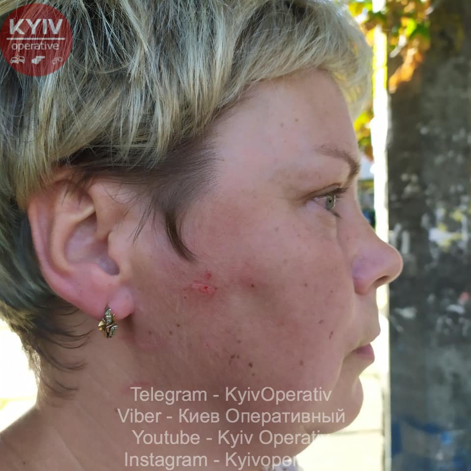 В Киеве водитель-мажорка избила продавщицу: в сеть попали фото