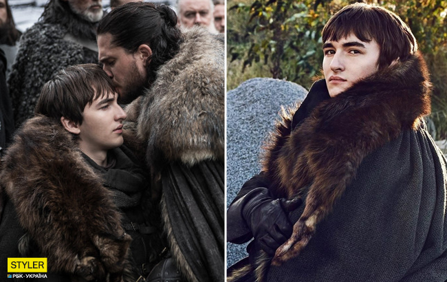 Я майже сліпий: зірка серіалу &quot;Гра престолів&quot; зробив зізнання