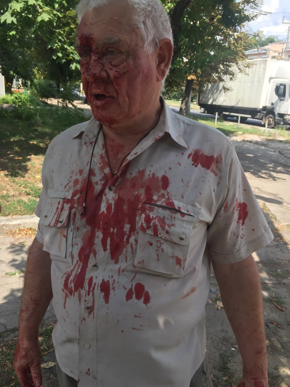 Поліцейський побив онкохворого пенсіонера в трамваї: з'явилися нові деталі