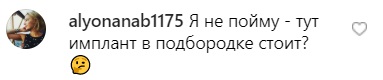 Пугачева в веснушках озадачила фанатов помолодевшим видом