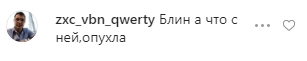 Совсем опухла: фанаты в шоке от вида Ани Лорак