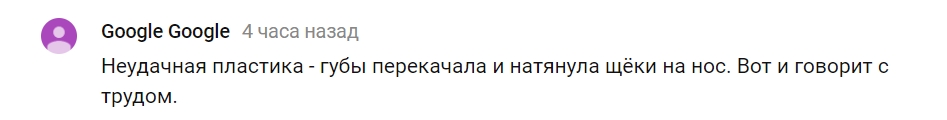 &quot;Говорить важко&quot;: українці були шоковані зовнішнім виглядом Білик