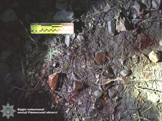 поїзд, нога