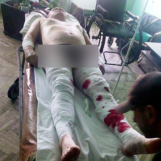 Вибух в Івано-Франківській області: скоєно замах на чиновника РДА