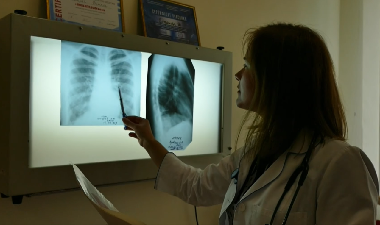 Українцю давали лише 1% на одужання: дивовижна історія перемоги над COVID-19