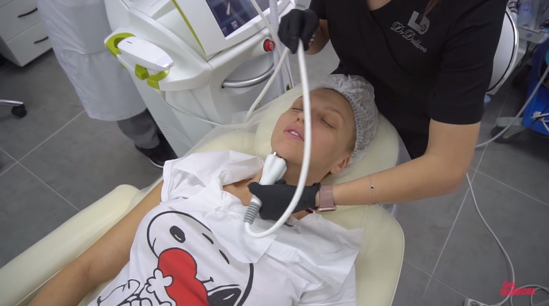 "Колю ботокс": Оля Полякова відверто розповіла про свої б'юті-процедури