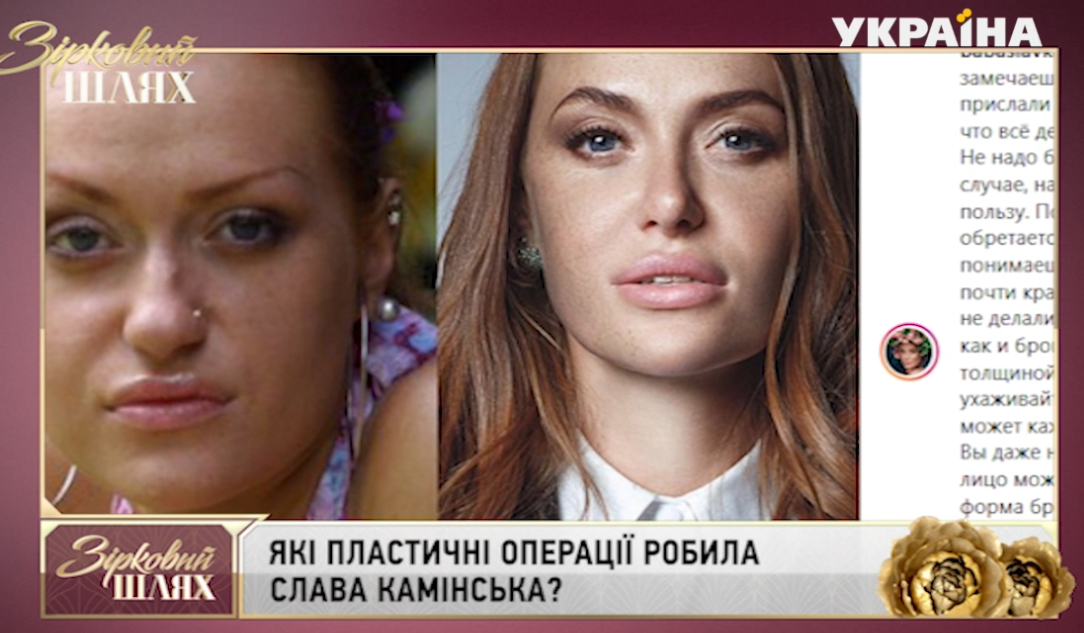 Была бы похожа на шарпея: Слава из НеАнгелов раскрыла детали своих пластических операций